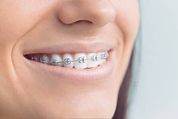 Dental Inlays and Onlays in Scaggsville, MD